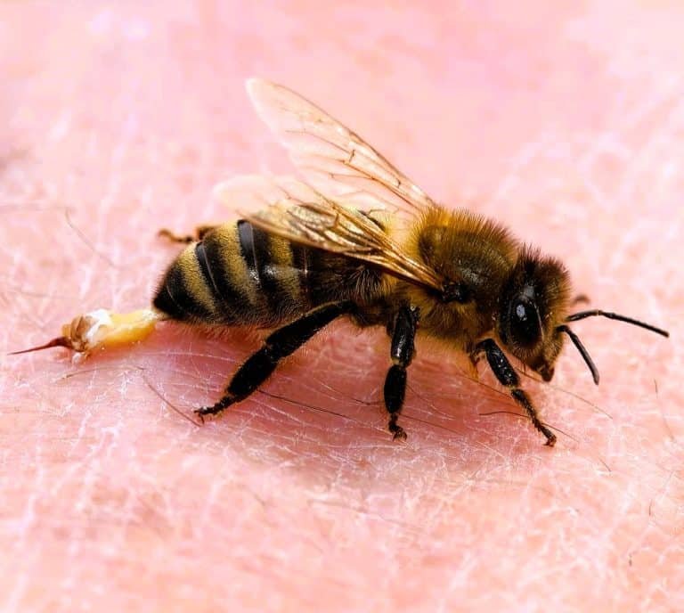 honeybee sting